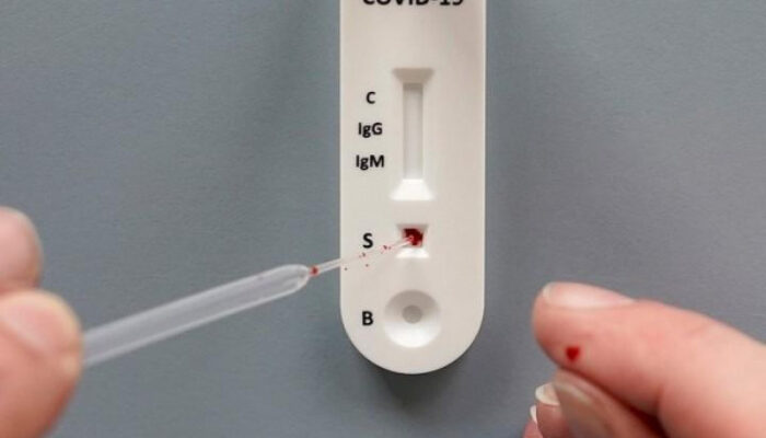 203 Anggota Bawaslu Halbar Jalani Rapid Test