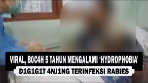 VIDEO : Viral, Bocah 5 Tahun Mengalami ‘Hydrophobia’ Digigit Anjing Terinfeksi Rabies